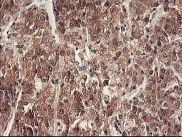 Monoclonal Mouse anti-Human RBBP7 / RbAp46 Antibody (clone OTI5A4, IHC, WB)
