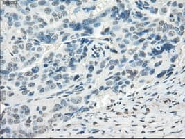 FRA-1 / FOSL1 Antibody (clone OTI12F9)