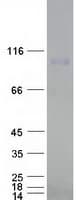 Human CSE1L Protein (Recombinant Myc-DDK (Flag))
