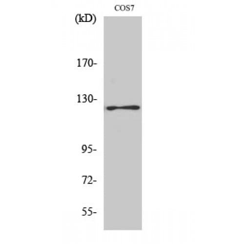 FAK / Focal Adhesion Kinase Antibody (800-880 aa)