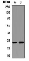 IHC-plus™ Polyclonal Rabbit anti-Human AQP2 / Aquaporin 2 Antibody (C-Terminus, IHC, IF, WB)