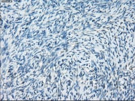 PRKAR1A Antibody (clone OTI6C7)