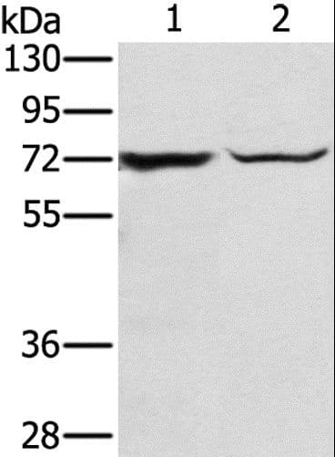Polyclonal Rabbit anti-Human SLC25A13 / CITRIN Antibody (IHC, WB)