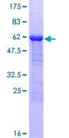 Human PDLIM1 Protein (Recombinant GST)