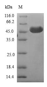 Human B9D2 Protein (Recombinant GST, N-terminus)
