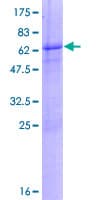Human KIF6 Protein (Recombinant GST)