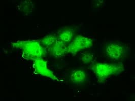 PIM2 / Pim-2 Antibody (clone OTI8H10)