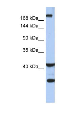 DISPA / DISP1 Antibody (aa575-624)