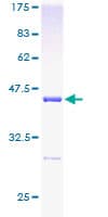Human UBE2L3 / UBCH7 Protein (Recombinant GST)