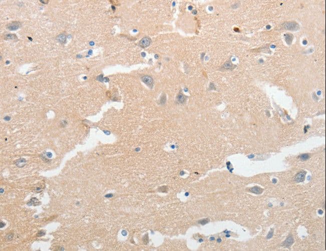 Polyclonal Rabbit anti-Human LCN2 / Lipocalin 2 / NGAL Antibody (IHC)