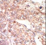 EPHA1 / EPH Receptor A1 Antibody (aa29-60)