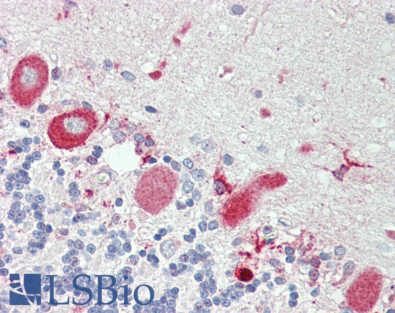 IHC-plus™ Polyclonal Rabbit anti-Human TNFRSF21 / DR6 Antibody (aa356-385, IHC, WB)