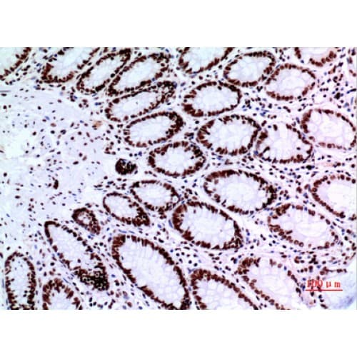 Polyclonal Rabbit anti-Human TP73 / p73 Antibody (IHC, WB)