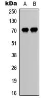 Polyclonal Rabbit anti-Human CDC25A Antibody (phospho-Ser75, IHC, WB)