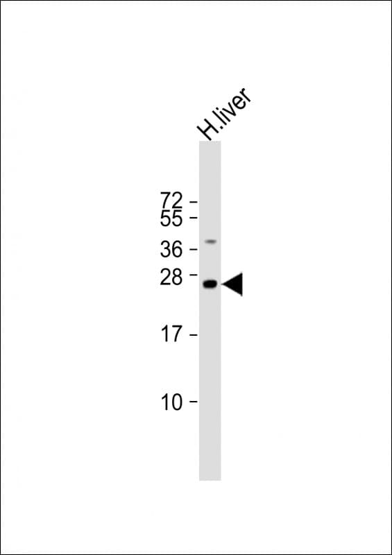 HNLF / TMED4 Antibody (aa195-225)