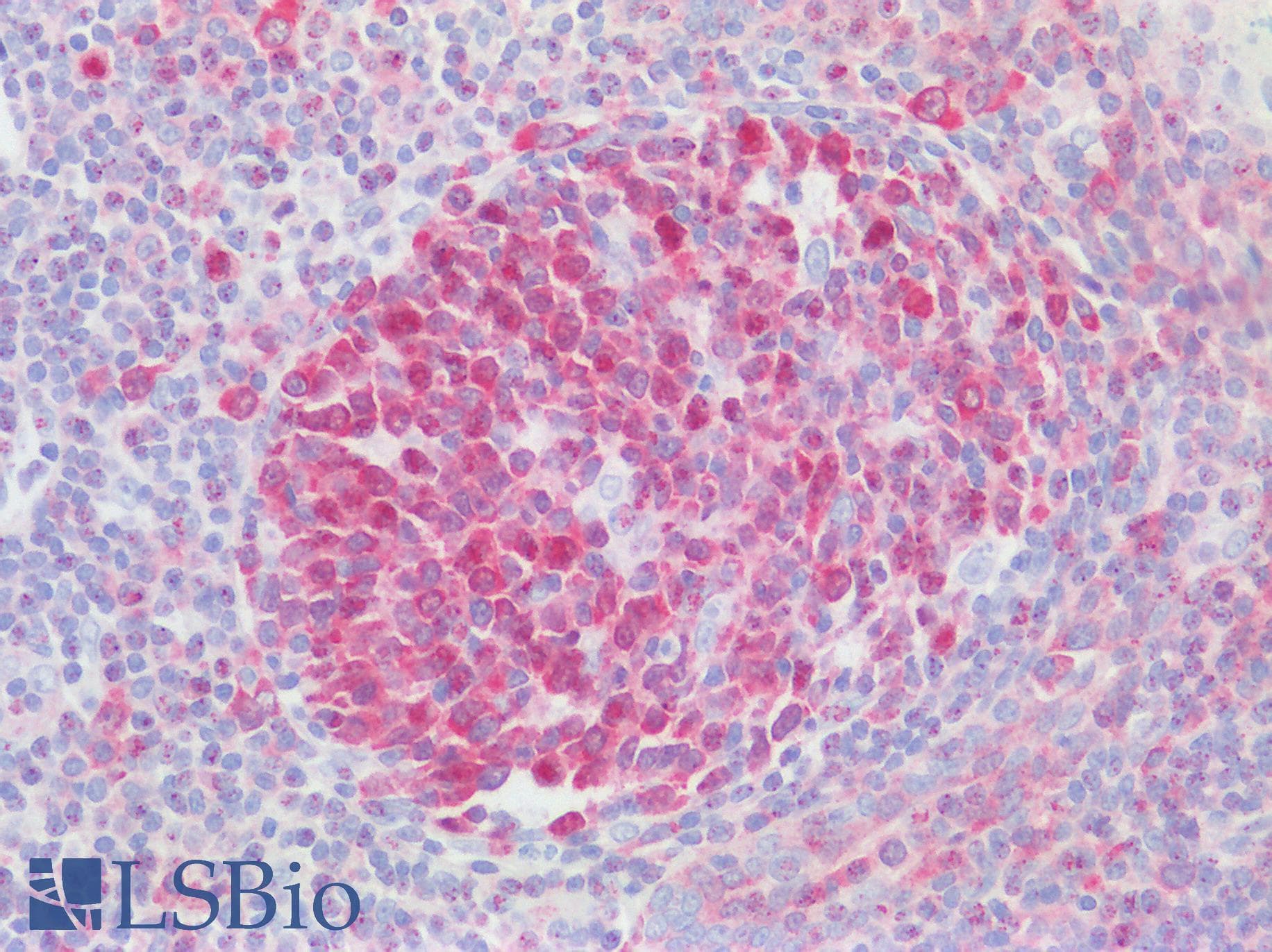 IHC-plus™ RANBP1 Antibody (aa1-50)