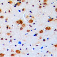 Polyclonal Rabbit anti-Human TOP3B Antibody (N-Terminus, IHC, WB)