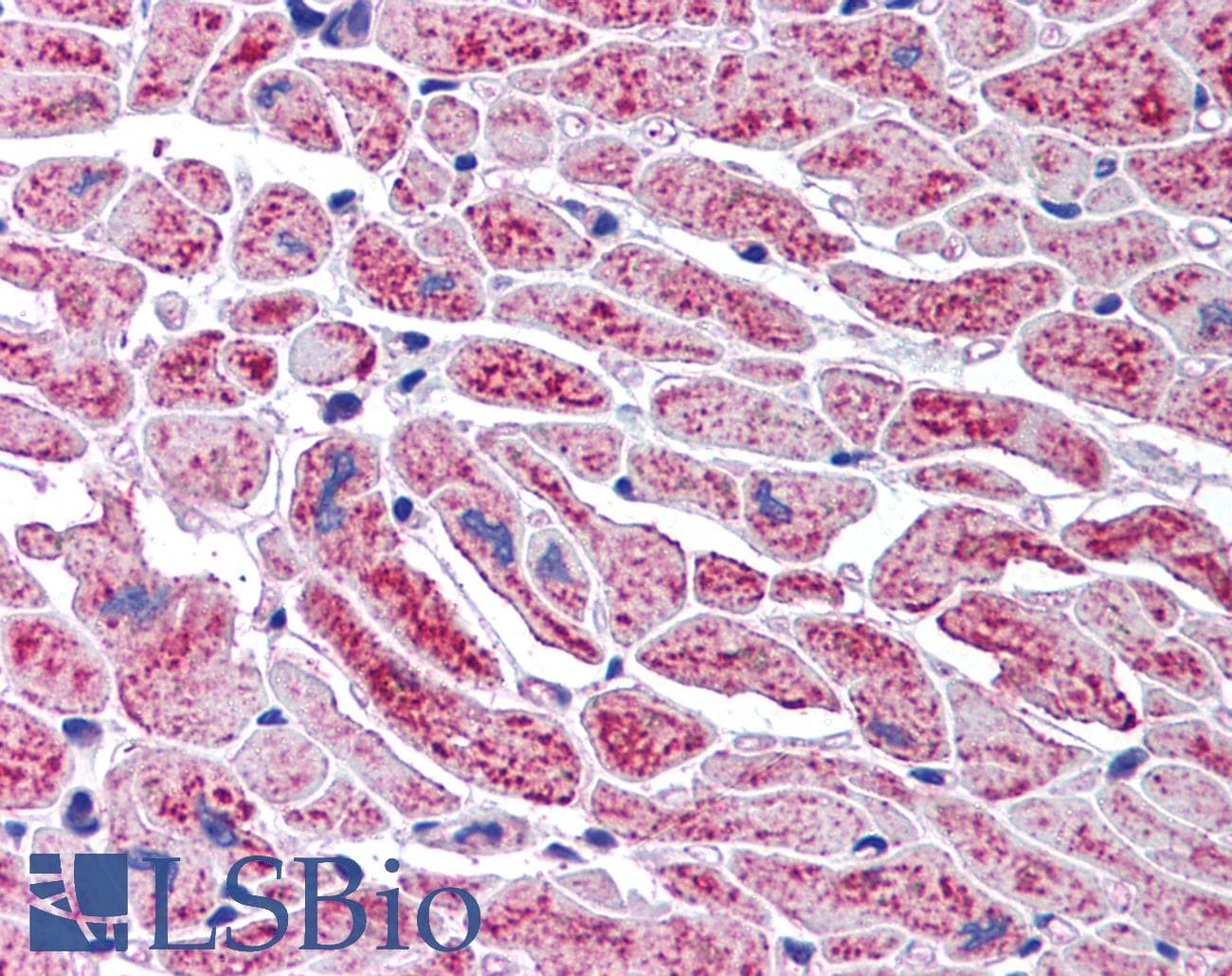 IHC-plus™ DCLRE1A / SNM1 Antibody (aa1032-1044)