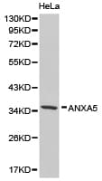 ANXA5 / Annexin V Antibody