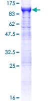 Human APH / APEH Protein (Recombinant GST)