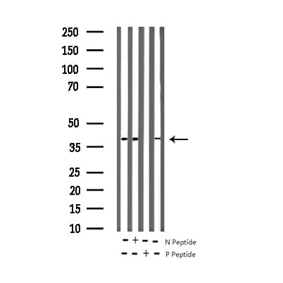 CREB1 / CREB Antibody (phospho-Ser133)