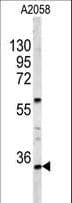 IHC-plus™ Polyclonal Rabbit anti-Human HOXA9 Antibody (aa245-272, IHC, WB)