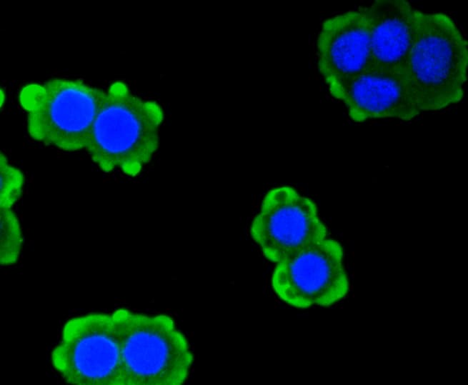 PRKCA / PKC-Alpha Antibody