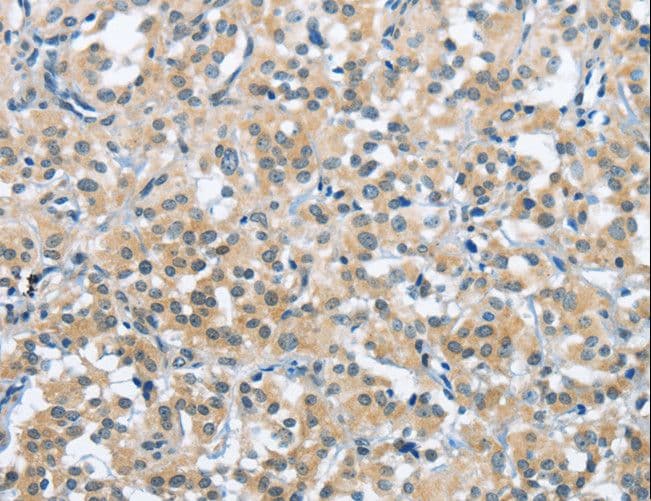 Polyclonal Rabbit anti-Human TRDMT1 / DNMT2 Antibody (IHC)