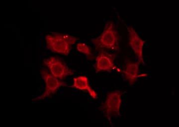 OR5W2 Antibody