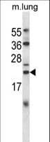 IHC-plus™ CRYAB / Alpha B Crystallin Antibody (aa84-112)