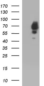 Monoclonal Mouse anti-Human SCP2 / SCPX Antibody (clone OTI1E4, IHC, WB)