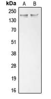 Polyclonal Rabbit anti-Human COL11A1 / Collagen XI Alpha 1 Antibody (Internal, IHC, IF, WB)