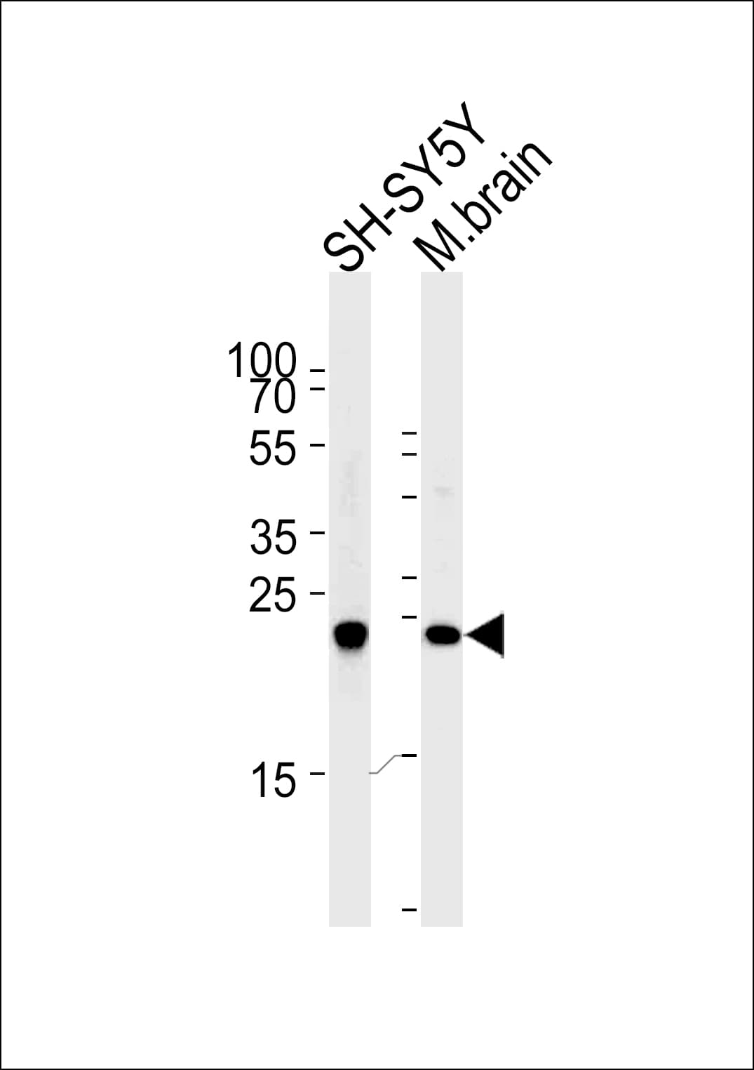 IHC-plus™ UCHL1 / PGP9.5 Antibody (aa187-214)