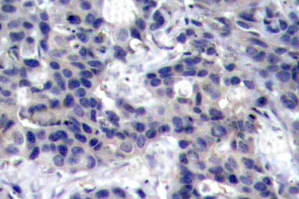 EIF2AK2 / PKR Antibody (Lys440)