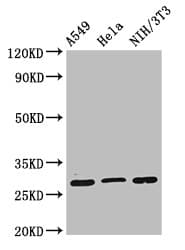 Polyclonal Rabbit anti-Human RPS2 / Ribosomal Protein S2 Antibody (IHC, WB)
