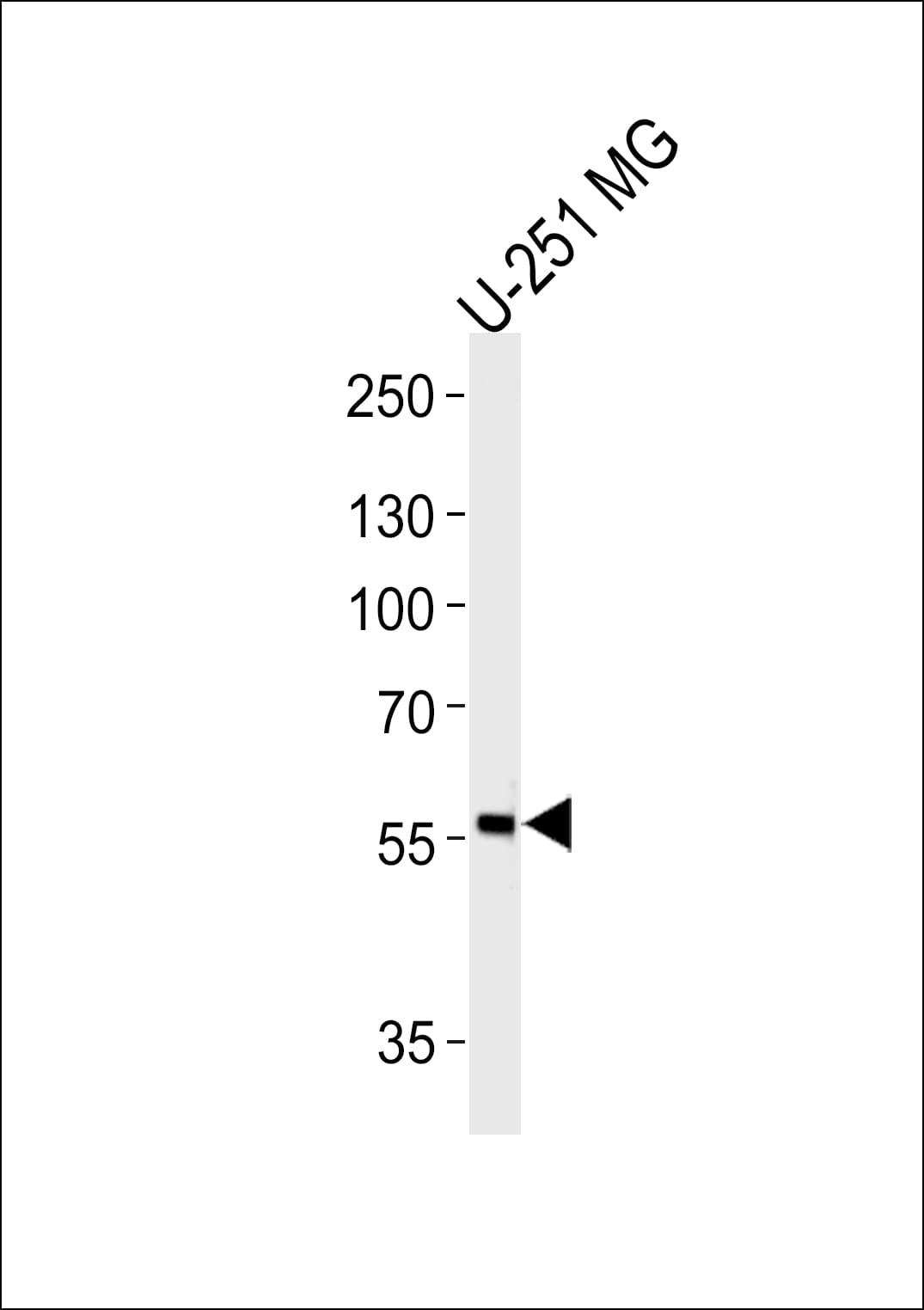 Polyclonal Rabbit anti-Human JADE1 / PHF17 Antibody (aa22-51, IHC, WB)