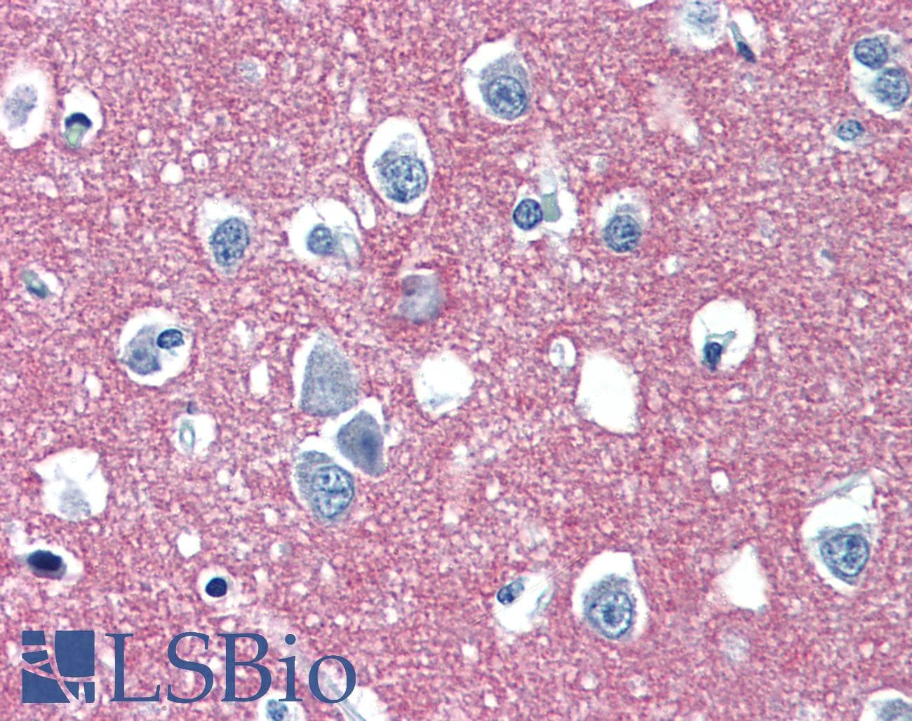 PathPlus™ L1CAM Antibody (clone UJ127.11)