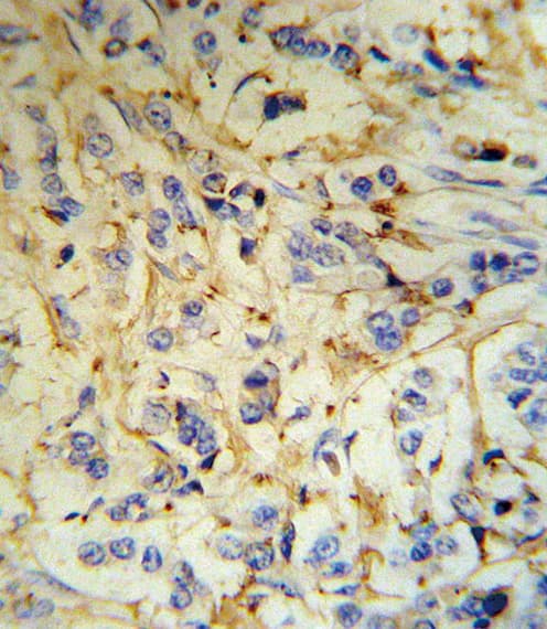 FGA / Fibrinogen Alpha Antibody (aa116-144)
