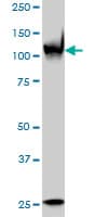 Monoclonal Mouse anti-Human PARP1 Antibody (clone 3G4, IF, WB)
