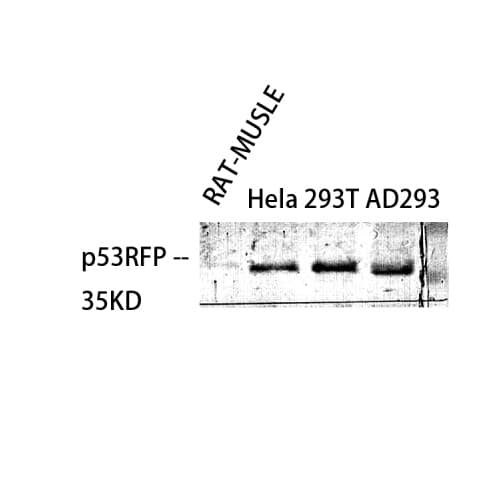 RNF144B Antibody (Internal)