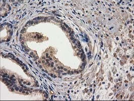DSTN / Destrin Antibody (clone OTI2C10)