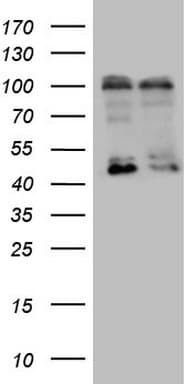 Polyclonal Rabbit anti-Human GPR49 / LGR5 Antibody (C-Terminus, WB)