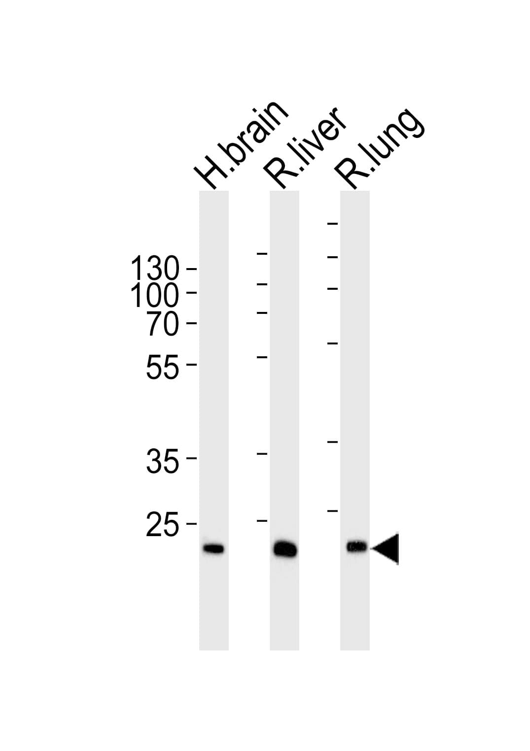 GSTT1 Antibody (aa46-79)
