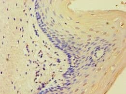 Polyclonal Rabbit anti-Human MCMBP / C10orf119 Antibody (aa1-240, IHC)