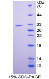Rat GATA1 Protein (Recombinant His-T7)