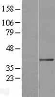 Human DTX3 Protein (Over-Expression Lysate Myc-DDK (Flag))