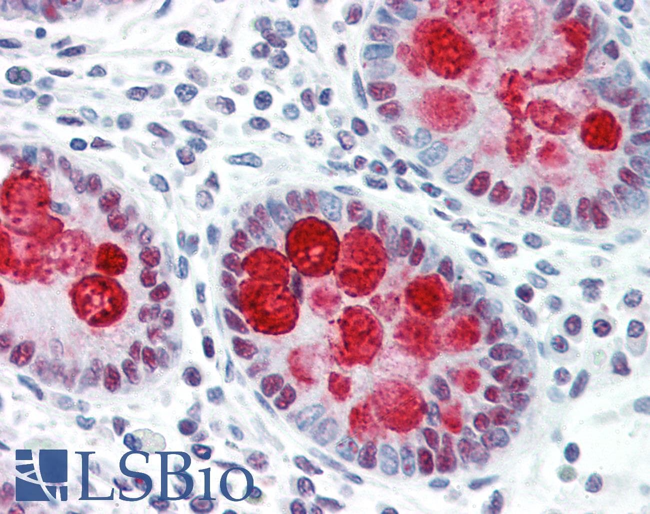 IHC-plus™ DFFA / ICAD / DFF45 Antibody