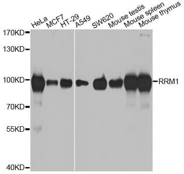 R1 / RRM1 Antibody