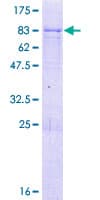Human RBMY1F Protein (Recombinant GST)