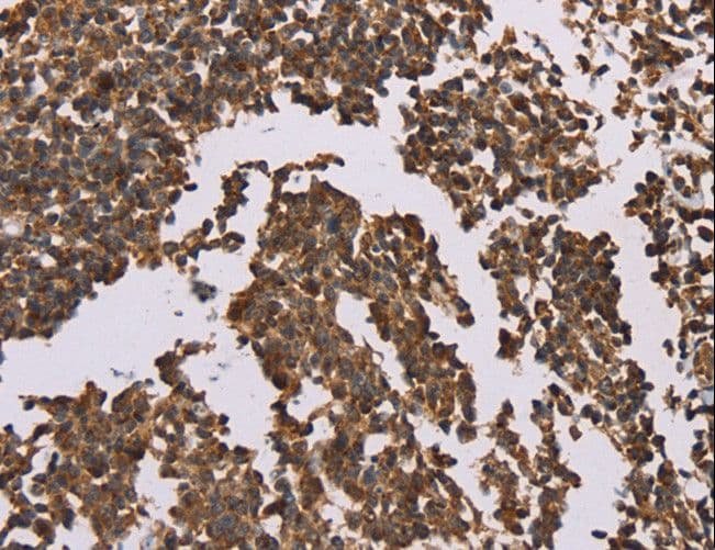 Polyclonal Rabbit anti-Human OTC Antibody (IHC, WB)